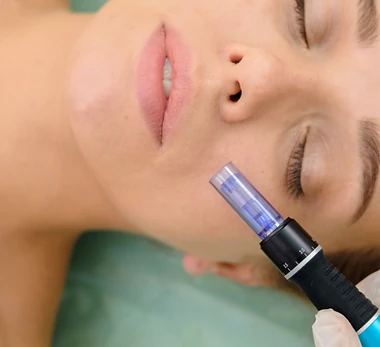 Facial Microneedling